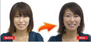 5分で歯を白く綺麗に見せるホワイトニング法「5min White Smile」 定価：¥9,800