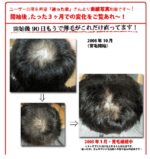 もうハゲとは言わせない！薬物系育毛剤・シャンプーを使わない超育毛・発毛術『極楽育毛革命』 定価：¥19,800