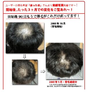 もうハゲとは言わせない！薬物系育毛剤・シャンプーを使わない超育毛・発毛術『極楽育毛革命』 定価：¥19,800